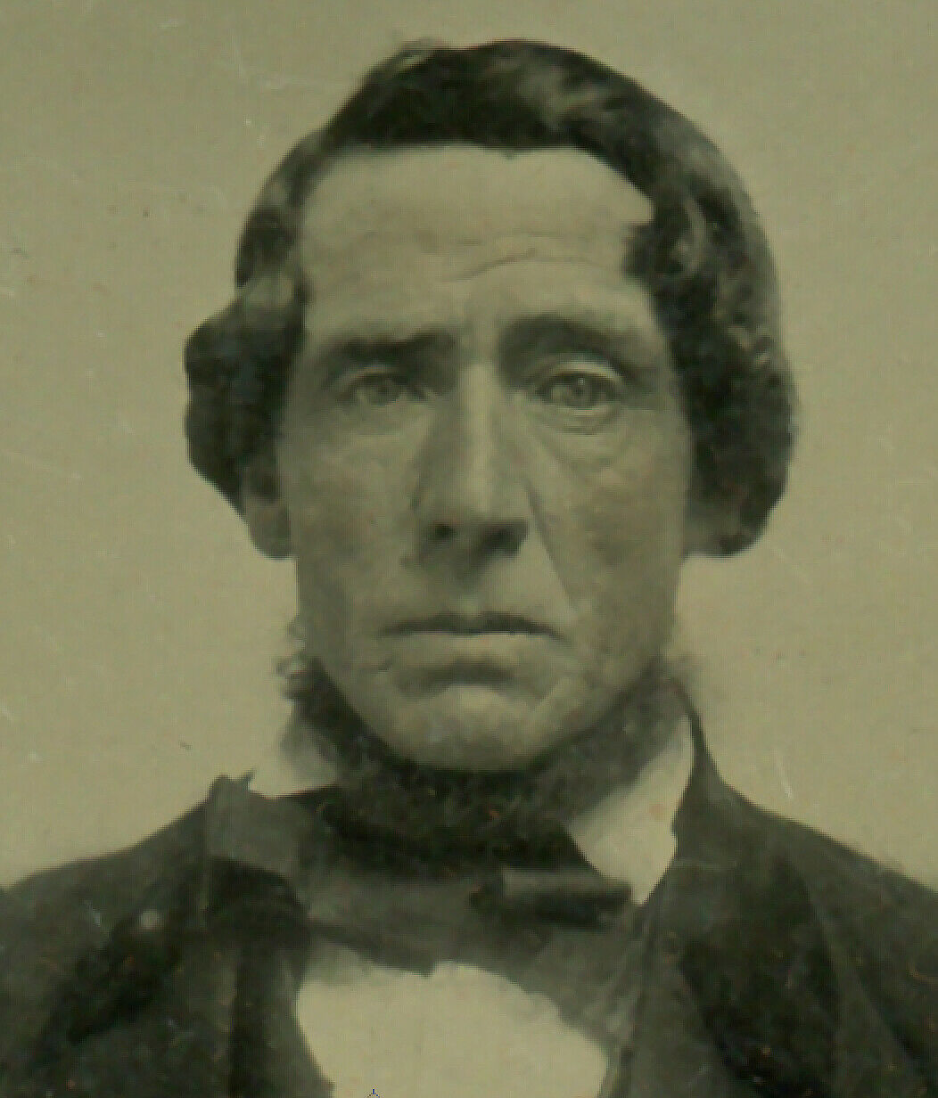 Ambrotype of Gentleman With NECK BEARD .... Even Henry David Thoreau Had One!